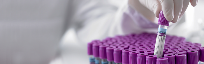 View Vancive's custom formulated adhesive platforms
